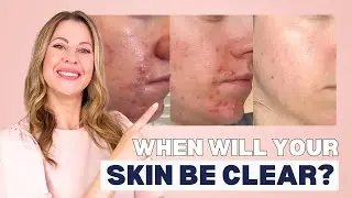 12 Weeks to Clear Skin: How to Make Science Work for You