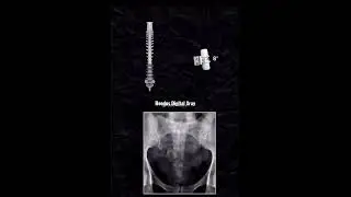 How To Take a Spin Reedus Digital X Rays