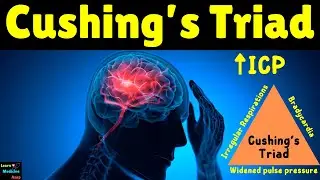 Cushing's Triad of Raised Intracranial Pressure (ICP) | Cushing Reflex | Cushing Phenomenon