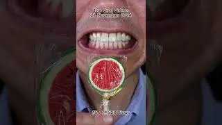 The Most Satisfying Chocolate and Candy NOT ASMR Compilation 🍫🍬 #DoctorTristanPeh #Chocolate #Candy