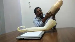 ReARM &ndash; Next Generation Smart Prosthetic arm