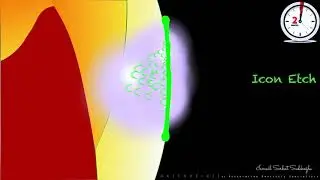 How to apply resin infiltration technique (Icon) ? Application steps animation ;)