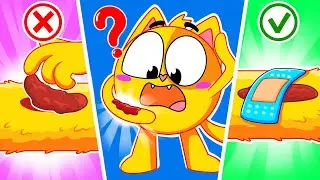 Why Do We Have Scabs 😨 | Funniest Cartoon For Kids By 4 Friends 😻
