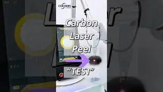 🎈 Precision vs. Power: The Ultra PicoCute Balloon Test! ⚡️  #cosmeticdermatology #cocoonlaser