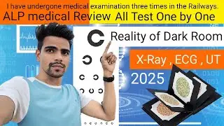 RRB ALP Medical Review 2025 🫨 ll Dark Room,ECG,Urin test,fundus test,X-ray,BP All test One by One ✅