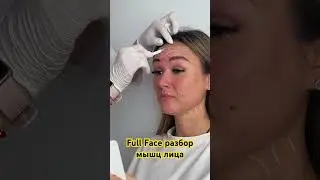 Ботокс full face разбор мышц лица, опасные зоны #доктор #акне #botox #диспорт#релатокс #косметолог