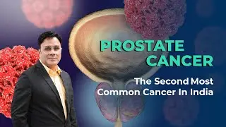 Prostate Cancer Second most common cancer in India | Dr. Vipin Tyagi #menshealth  #prostatehealth