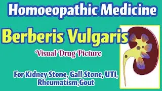 Berberis Vulgaris Homoeopathic Medicine Uses | Symptoms | Renal Stone, Gall Stone, Renal Colic