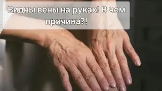 What do bulging veins on your arms indicate? For consultations, please contact: genomica21@yandex.ru