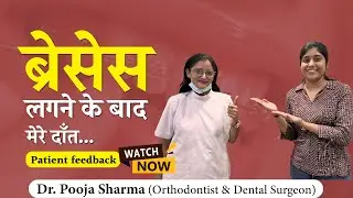 Patient Feedback After Braces Treatment In Agra, UP - Dr Pooja Sharma
