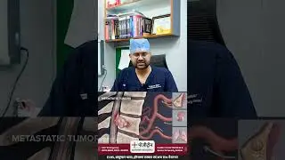 Free Cancer Camp Every Sunday | Bone Cancer Awareness with Dr. Pradeep