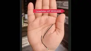 Break in Life line
