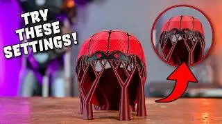 Want EASY Supports Removal for 2025? Watch This!