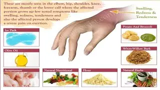 How to Immediately Treat an Injury Yourself: The R.I.C.E Protocol