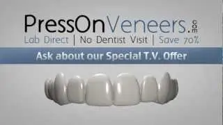 Snap On Smile Cost Compared To Press On Veneers