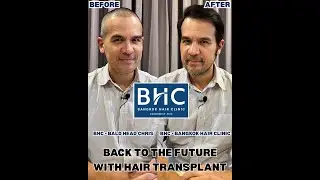 Back to the Future with Hair Transplant by Ajarn Chris