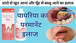 दांतो से खून आना, मुँह से बदबू आना और पायरिया के लिए सबसे अच्छी दवा || pairiya problem solution