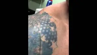 Tatt2away 3rd session