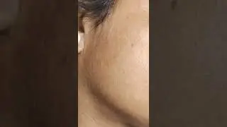 full face threading