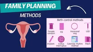 What is Birth Spacing ? | What are all methods of Contraception available? | #contraception