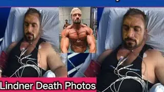 Joe Aesthetic Death Reason ? Joe Lindner Biography In Hindi | Bodybuilder Death News - Amit KB
