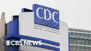 The foods you should avoid as the cyclosporiasis outbreak grows