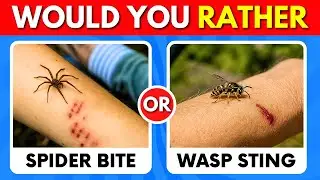 Would You Rather - 100 HARDEST Choices Ever! 🔥🤯🧠
