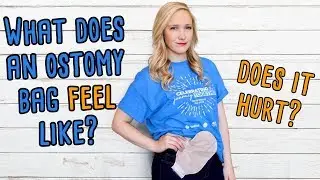 WHAT DOES AN OSTOMY BAG FEEL LIKE? DOES YOUR STOMA HURT?