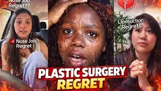 Women Are Finally Admitting The Painful Trust  About Plastic Surgery