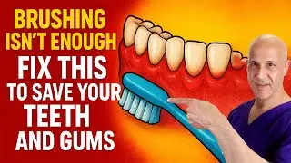 Brushing Isn&rsquo;t Enough &mdash; Fix This to Save Your Teeth and Gums | Dr. Mandell