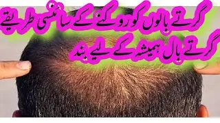Stop hair loss forever