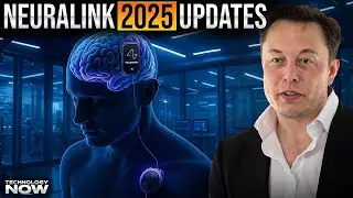 Neuralink 2025 update: 7 Brain Implants, AI Control & A New Human Era Begins!