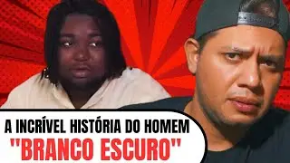 A história do homem negro que se identifica como um branco de 35 anos ( E você Qual seu gênero? )