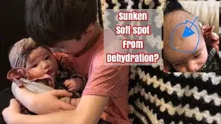 sunken soft spot from dehydration? / vlogmas