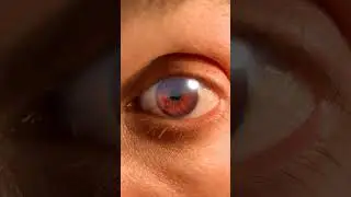 Настоящий органический Мангекё Шаринган / Риннеган в РЕАЛЬНОЙ ЖИЗНИ (Учиха Мадара) Slimy 3D Tomoe...