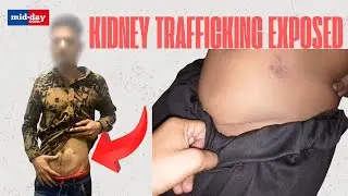 Kidney Trafficking Exposed: The Dark Truth Behind Illegal Organ Trade!