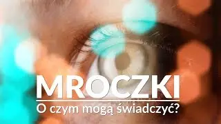MROCZKI PRZED OCZAMI jak sobie radzić