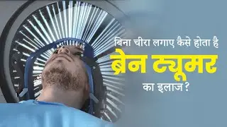 Brain Tumor Treatment in Hindi | Brain Tumor Gamma Knife Surgery Treatment in Hindi