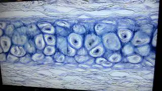 A&P1 Lab#3 elastic cartilage