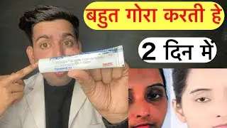 Panderm++ | Panderm plus cream | panderm plus | panderm plus cream side effects | Panderm puls uses