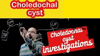 Ep 2 - Choledochal Cyst Investigations || Dr. Khaled Salah