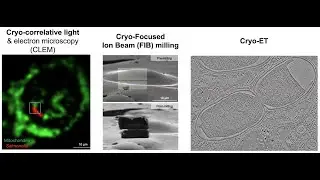 Park_Introduction_cryo-ET