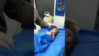 Healthy Newborn Baby Moro Reflex⚠