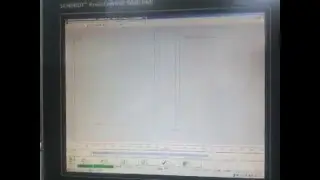 SCHMIDT&reg;  - Compliant Pin assembly