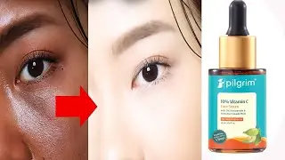 ⚡ Pilgrim Vitamin C Serum Honest Review | Dark Spots, Pigmentation & Glow Test 🔥