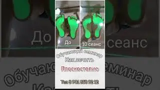 как много детей нуждаются в эффективному лечении... стань частью профессионалов, я научу. #массаж
