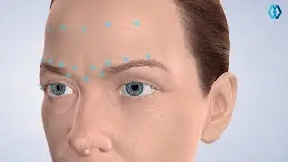 Botox at North Jersey Oral & Maxillofacial Surgery, Teaneck, NJ