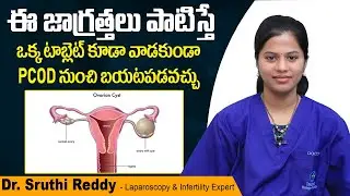 PCOD పూర్తిగా తగ్గాలంటే || Tips to Cure PCOD Naturally in Telugu || Treatment Range Hospitals