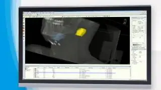elekta flexitron oncentra brachy video
