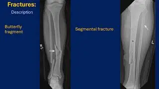 D. K. Bielecki - Physical injury: Basic concepts - part I.